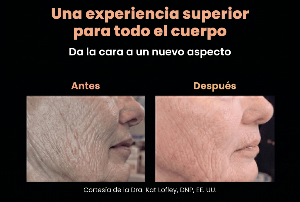 qualityX2